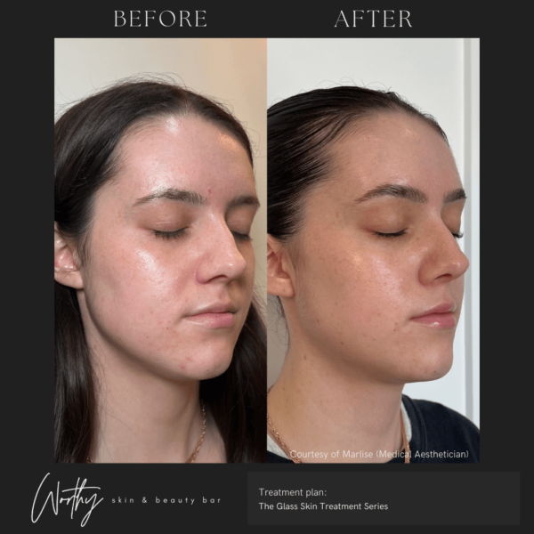 Skincare Bootcamp ($24.99/month) - Image 2