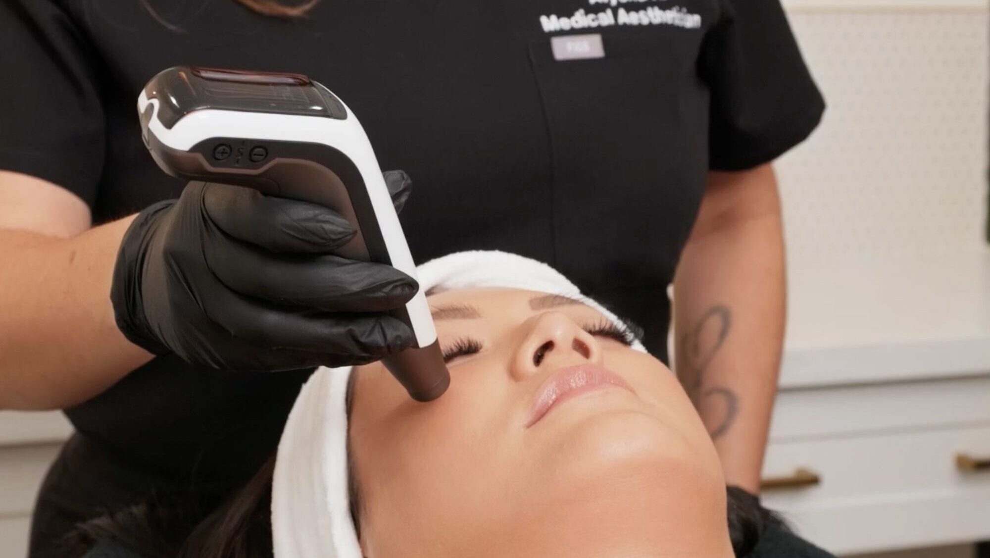 A medical aesthetician administers microneedling after a patient's PRP shots near Kitchener.
